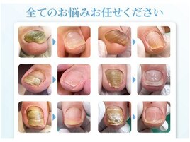 足に関する専門店です！