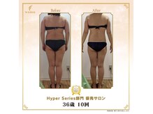 タノソイネ(tanosoine)/【30代ハイパーナイフ痩身】