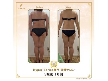 タノソイネ(tanosoine)/【30代ハイパーナイフ痩身】