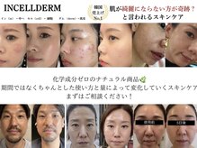 ヴィディトゥ(vidyto)