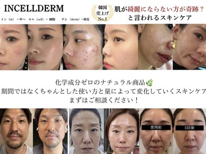 ヴィディトゥ(vidyto)の写真