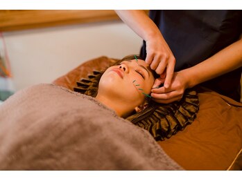 黒田鍼灸治療院/美容鍼施術風景