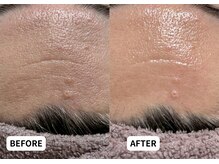 エルナ(Eluna)/美肌覚醒プログラム　セルマン