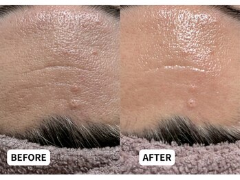 エルナ(Eluna)/美肌覚醒プログラム セルマン