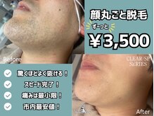 ミミロンビューティー(Mimiron Beauty)の雰囲気（痛み少なく驚くほど抜ける！男の透明感◎清潔感爆上がりモテ脱毛）