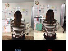 ストレチックス 近江八幡店/首・肩に痛みがあった女性