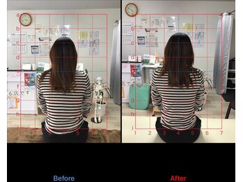 ストレチックス 近江八幡店/首・肩に痛みがあった女性