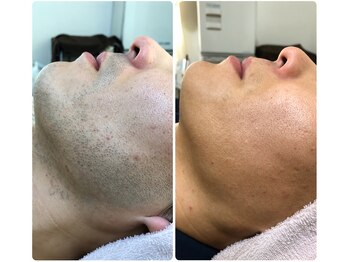 ゴールドプラス 伊勢店(GOLD PLUS)/BeforeAfter
