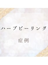 サロンツキ(salon tuki)/ハーブピーリング症例