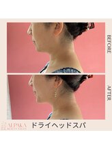 アルパカ(ALPAKA)/小顔ケア付きドライヘッドスパ