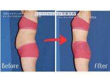 エンダモロジーサロン ココロミ(Cocolomi)/エンダモロジー結果写真２
