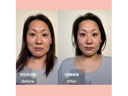 フェルナ(FERNA)の写真
