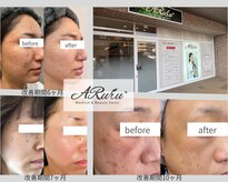 アルルプラス 南草津(ARuru+)