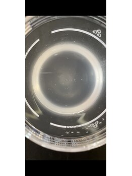 ルルン(LuLuN)/放置すると頑固黒ずみになります