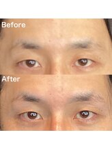 眉毛ハウス 吉祥寺店(眉毛HOUSE)/お客様の施術例(吉祥寺/東京)