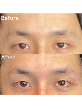 眉毛ハウス 吉祥寺店(眉毛HOUSE)/お客様の施術例(吉祥寺/東京)