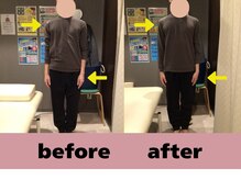 整骨院カイ 三宮(KAI)/辛い肩こり、ご相談ください！