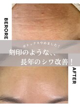 ルームエイトエイティスリー 新宿(R883)/究極のエイジングケア