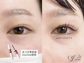 アイラッシュ リリオ(Lirio)/まつげ美容液/EGUTAM