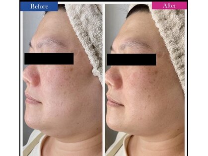 ティアレソワン(tiare soin)の写真