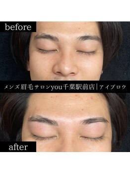 ユー 千葉駅前店(you)/ビフォ－アフター写真