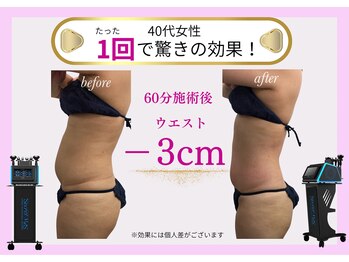 ベルフィーヌボーテ(BELFINE beaute)/痩身エステ60分1回
