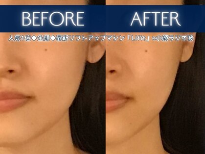 ブリリオ 天神店(Brillio)の写真