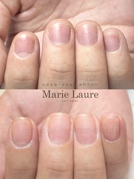 マリーロール 梅田店(Marie Laure)/深爪矯正/自爪育成/自爪風