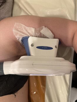 二の腕・ハミ肉ケアをしたい