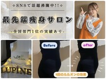 ヨサパーク ルピナス(YOSA PARK Lupine)