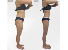 プリマルーチェ/プレミアム全身プログラム