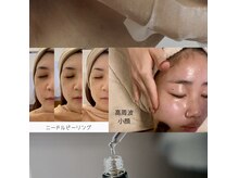 マ シェリエ(MA CHERIE)の雰囲気（小顔 ニキビ 美白はお任せ下さい。雪美人正規取扱い店です。）