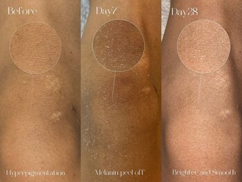 ヤエシーファイブクリニック(YAE C5 CLINIC)/札幌/ローマピンク