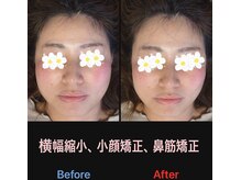 美容矯正サロン レレポノ(LELEPONO)/