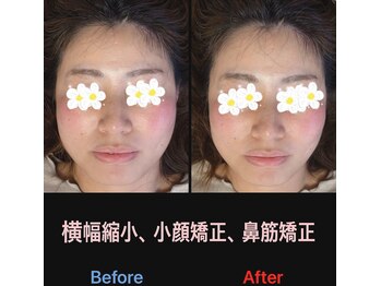 美容矯正サロン レレポノ(LELEPONO)/