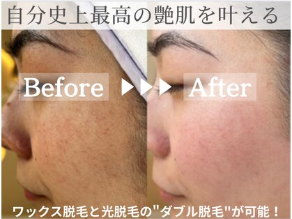 エリス(ELISSE)の写真