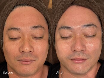 アウラ 小杉店(AULA)/ララピール☆