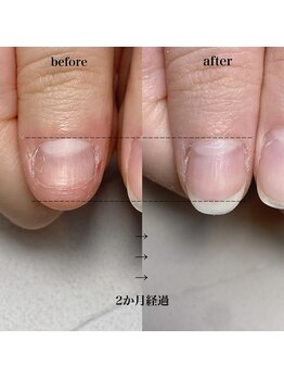 スマイルニコ(smile nico)/