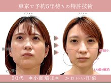 グレースエール トータルビューティーサロン(Grace Aile)/＊戻らないバランス小顔矯正＊