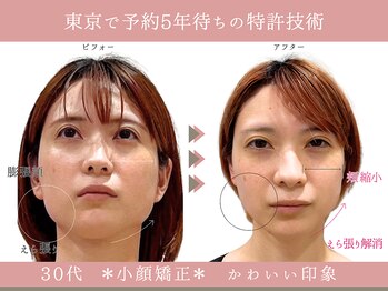 グレースエール トータルビューティーサロン(Grace Aile)/*戻らないバランス小顔矯正*