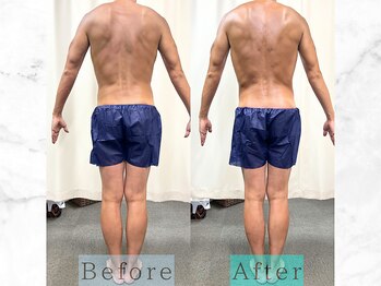 パラディ(PARADIS)/ハイパーナイフ/シェイプ