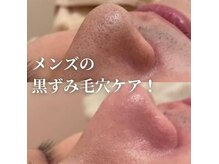 AI肌管理サロン レアリス【4月1日NEW OPEN】の雰囲気（メンズ/脱毛/毛穴ケア/ハイドラ洗浄/シミケア/頭皮マッサージ）