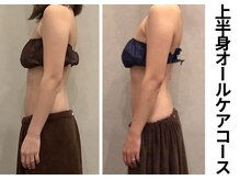 プラマイル(Pramile)/上半身オールケアコース