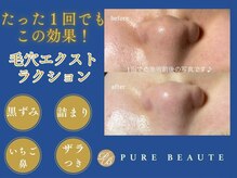 ピュアボーテ(PURE BEAUTE)