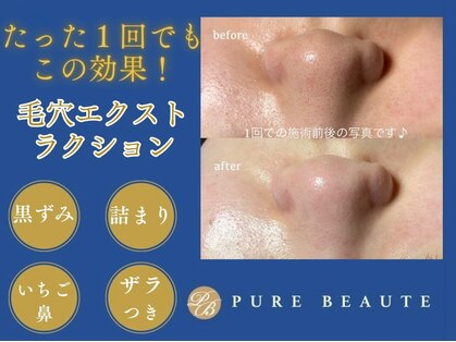 ピュアボーテ(PURE BEAUTE)の写真