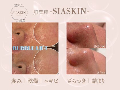 シアスキン(SIASKIN)の写真