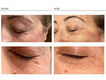 ファーレ 市ヶ尾店(FAREI)/アイパーフェクション1回の効果