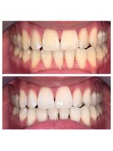 ライトビューティー 池袋店(LightBeauty)/症例写真