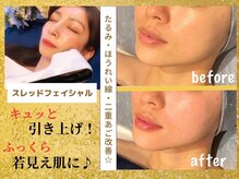 アールアンドエス(R&S)