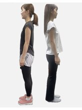 サンアップ(Sun UP)/【Before after】3ヶ月